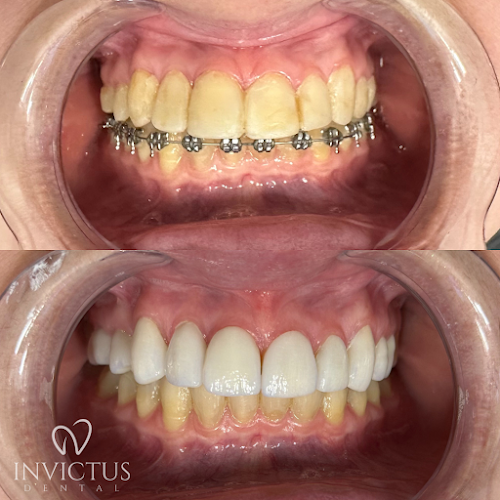 Invictus Modern Dentistry