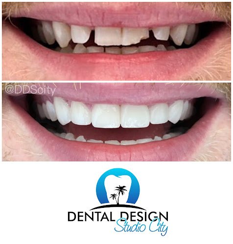 Dental Design Studio City
