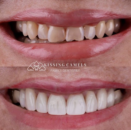 Kissing Camels Family Dentistry