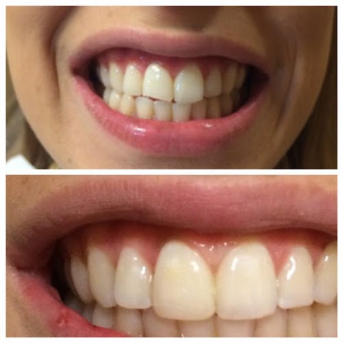 Emergency Dentist NYC