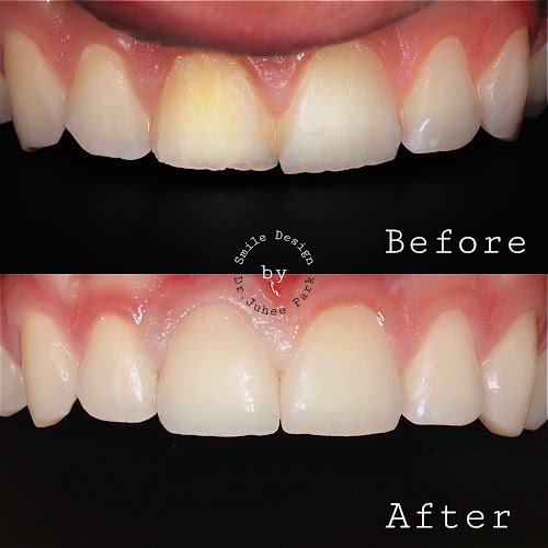 Island Dentistry : Smile Aesthetics