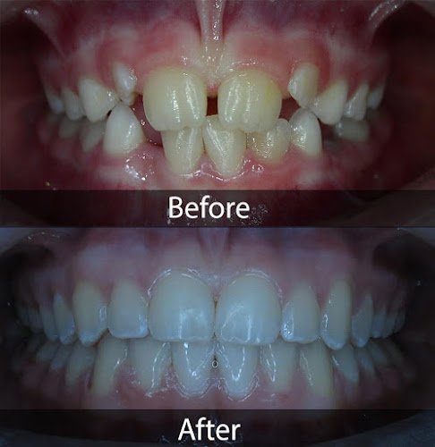 Aesthetic Dentistry of Arrowhead