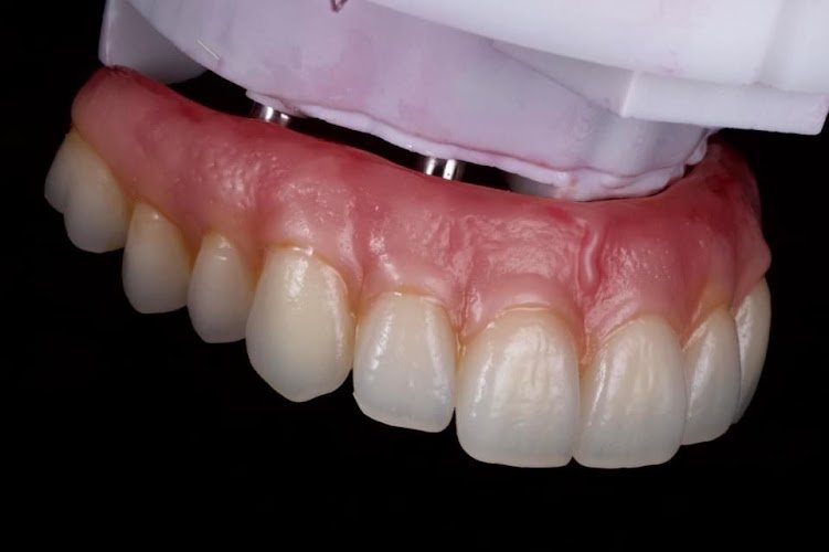 Hybrid Specialists Dental Laboratory