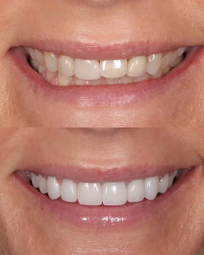 Peninsula Center of Cosmetic Dentistry Los Altos