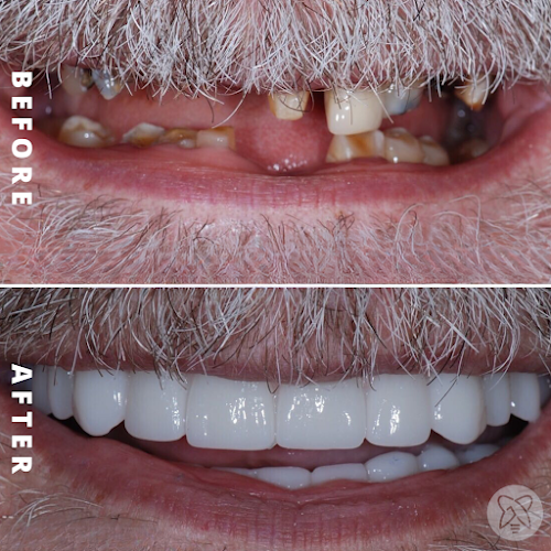 Great State Dental Lab