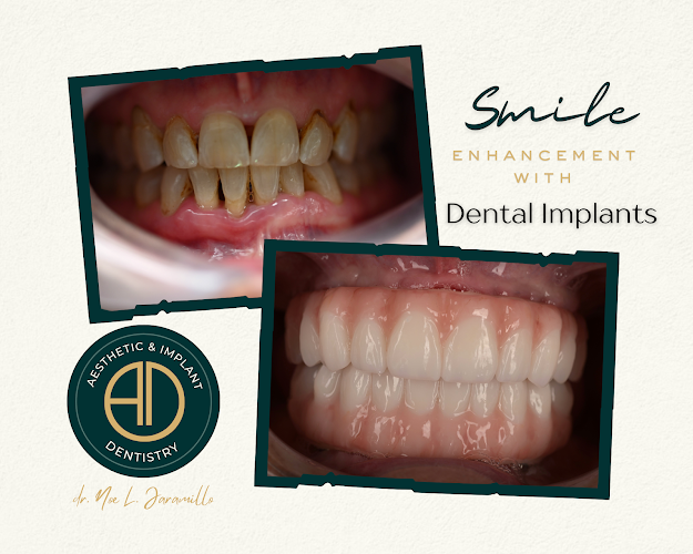 Aesthetic & Implant Dentistry