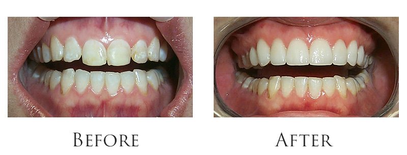 Weiser & Grant Dentistry