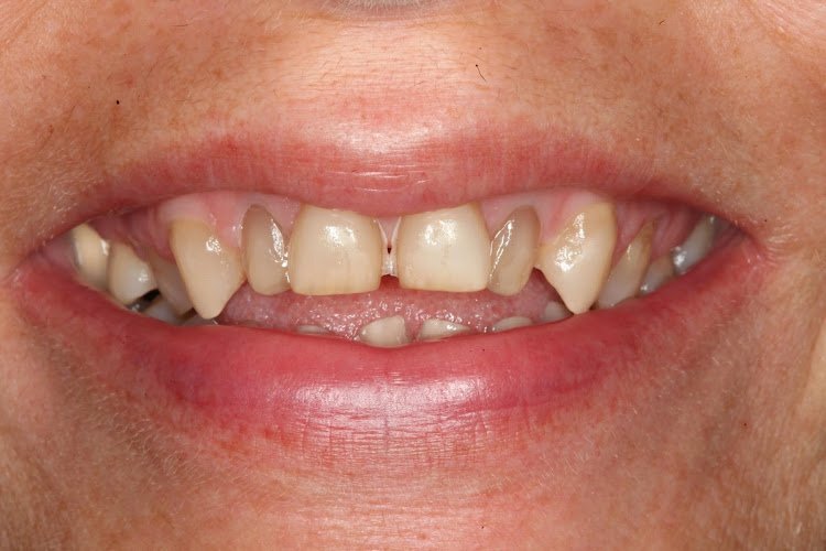 Mark B. Hughes, D.D.S. and Jupneesh Singh, D.D.S.