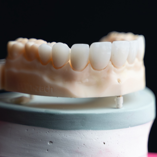 Pearce Dental Group of Cincinnati, OH