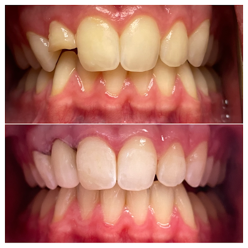 Preserve Your Teeth Dentistry – Alice Urbankova, DDS, PHD – Rockefeller Center, Manhattan