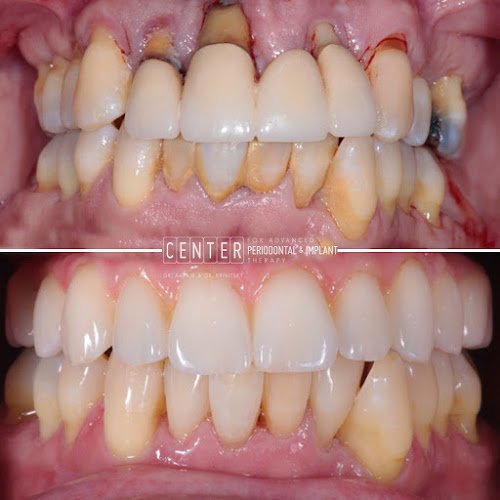 CENTER for Advanced Periodontal & Implant Therapy