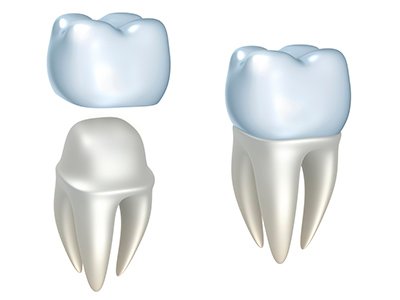 Dental crowns and tooth