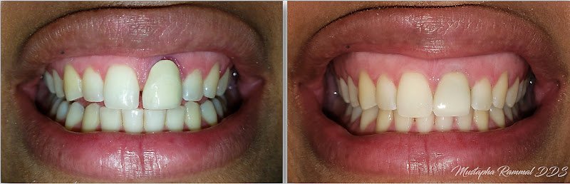 Dr. Mustapha Rammal DDS FICOI