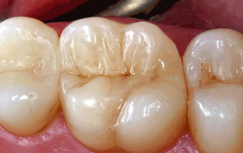 Brea Family Dental Center