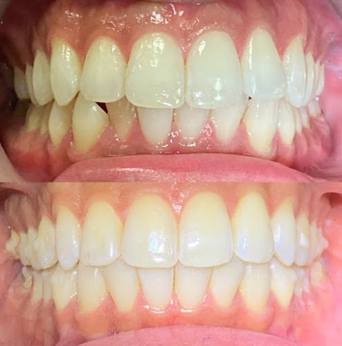 Apex Family Dental PC