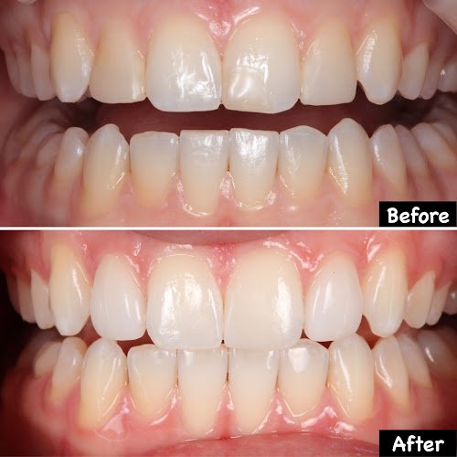 Michael W. Brumm DMD, CDT, FAACD