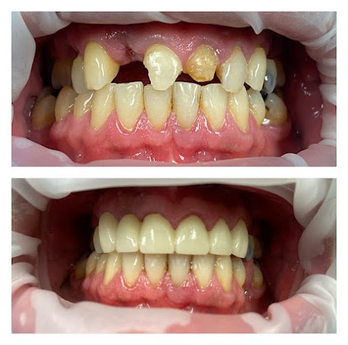 Bright Smile Dental Art