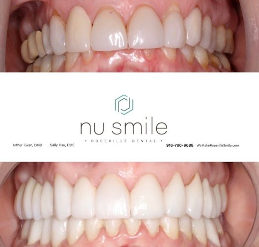 Nu Smile Roseville California • Cosmetic Dentist • Implant Periodontist • Invisalign Clear Braces