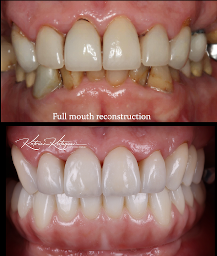 Dr. Katerina Kostagianni DMD, MS Smile Design & Implant Specialist