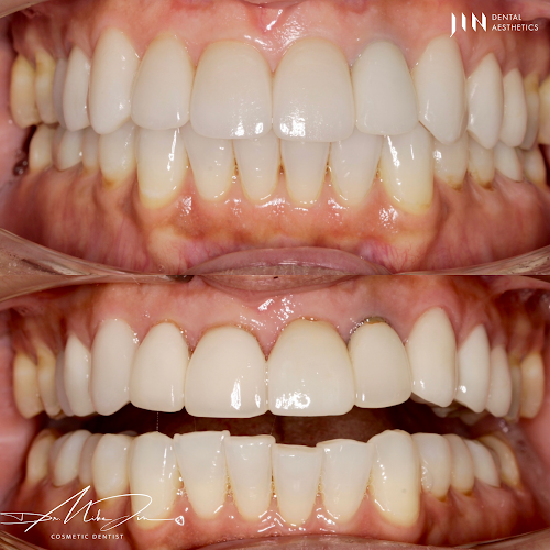 Jin Dental Aesthetics