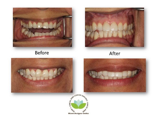 Miami Designer Smiles