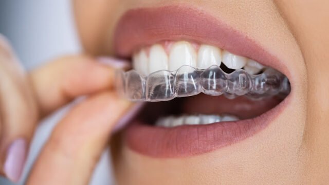 Clear Aligner Dental Night Guard For Teeth