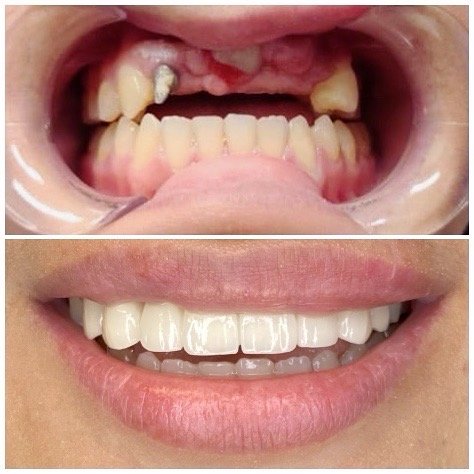 Signature Smiles Dental