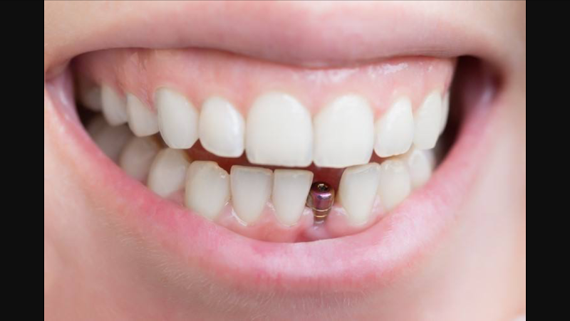 Concord Dental Group