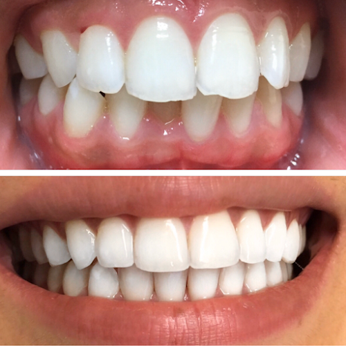 Maryam Hadian, DDS
Le Chic Dentist Los Angeles, CA