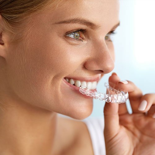 Columbine Creek Dentistry – Dentist Littleton