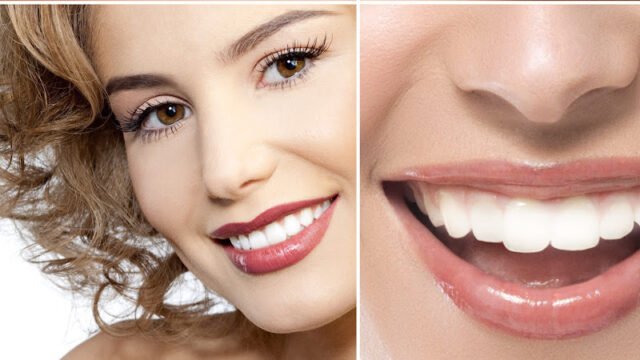 teeth collage of people smiles