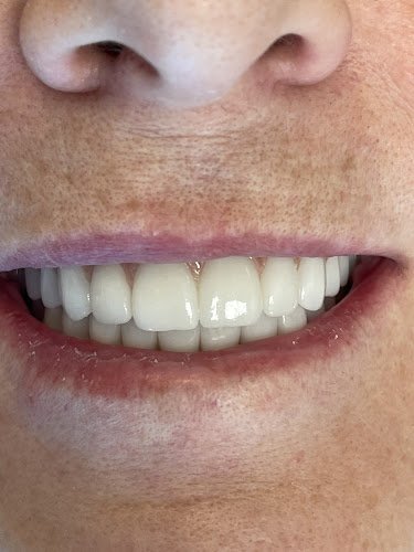 Marin Dental Implant Center