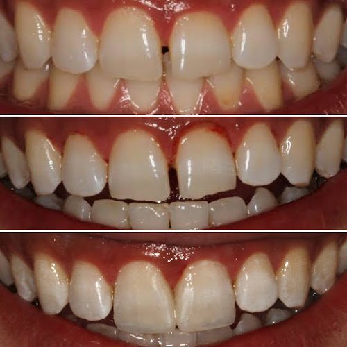 Beautiful Smiles Dentistry