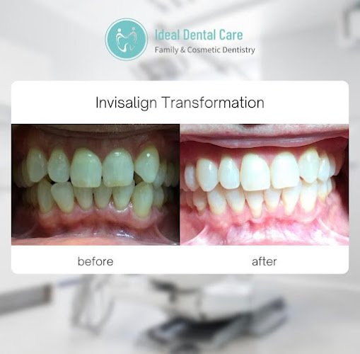 Ideal Dental Care, San Jose