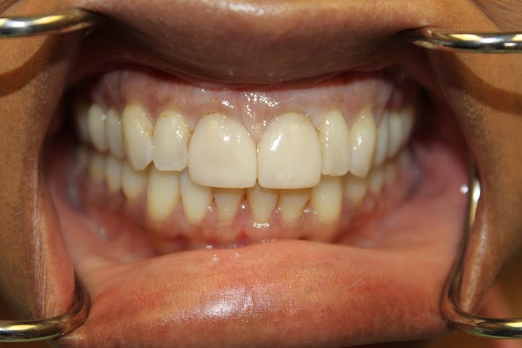 Advanced Dental Concepts – Laguna Beach