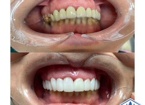 xr:d:DAFLxUygot0:12,j:34997198505,t:22091017