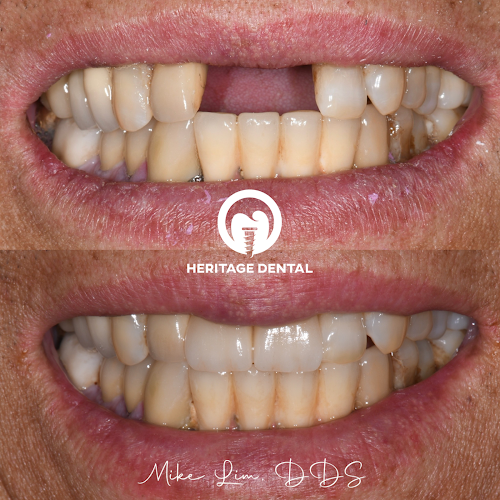 Heritage Dental