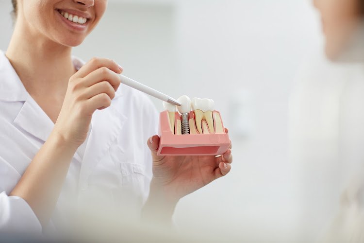 Roseville Dental Implants