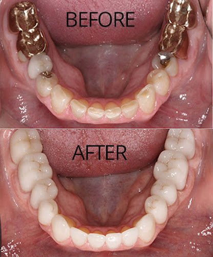 Dr. Anthony Mobasser – Celebrity Dentist