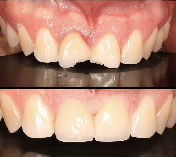 Advanced Family Dentistry