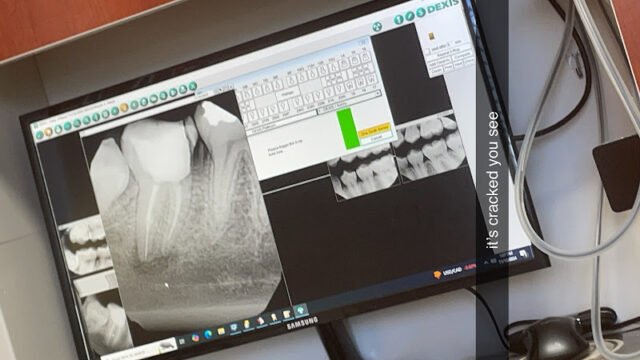 CjQKMFNuYXBjaGF0LzEzLjE2LjAuMzkgKGlQaG9uZTEzLDI7IGlPUyAxOC4wOyBnemlwKSAC