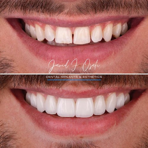 New Life Dental Implant Center