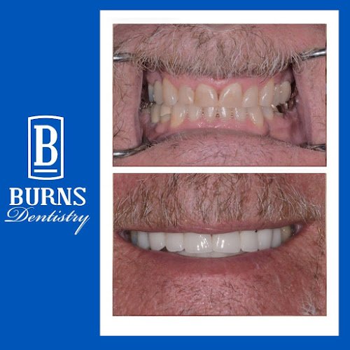 Burns Dentistry