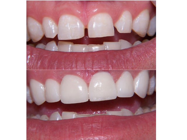 Seibert Complete Dentistry