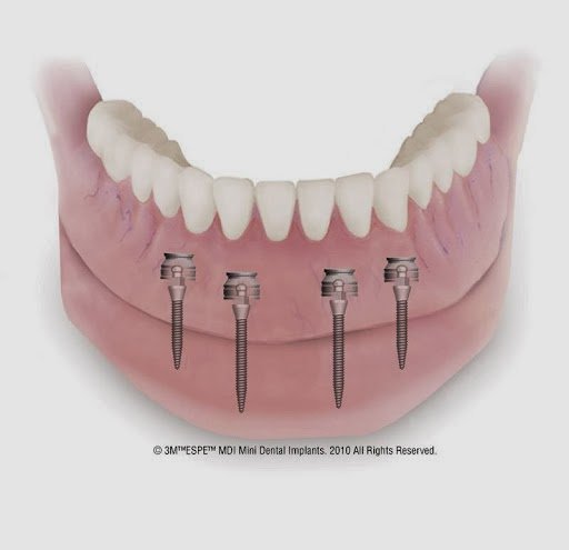 Dr. Flores Family Dental Office