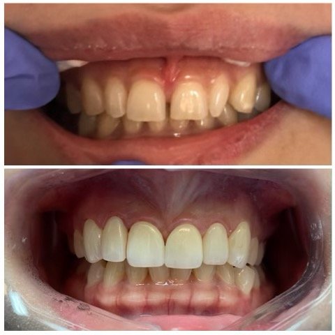 Paul Jang Dentistry – Moorpark Dentist