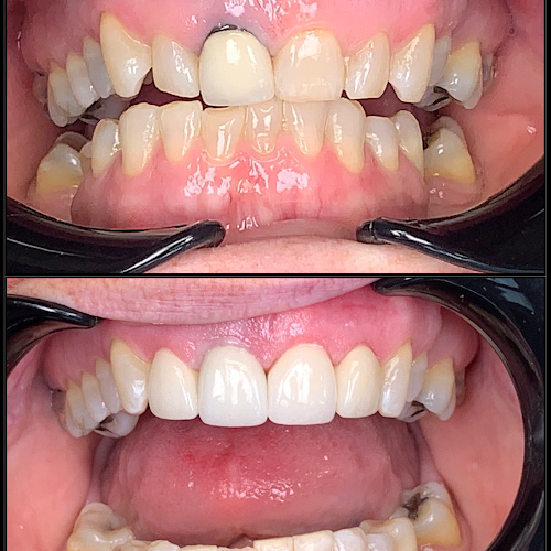 Rapid City Smiles: Implant & Family Dentistry