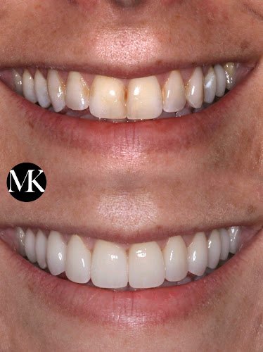Smiles of NYC – Michael Kosdon DDS