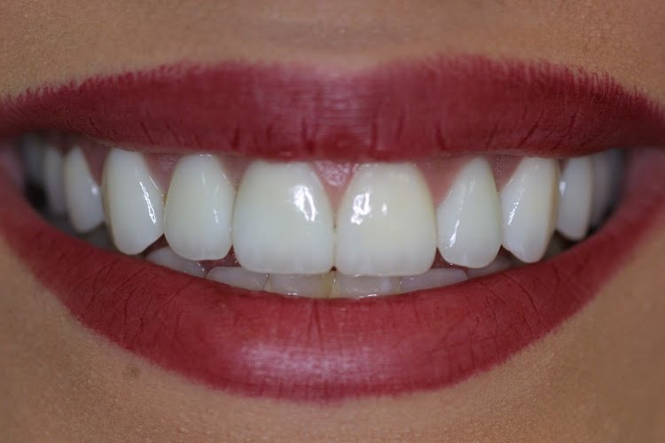 Mini Dental Implant Center