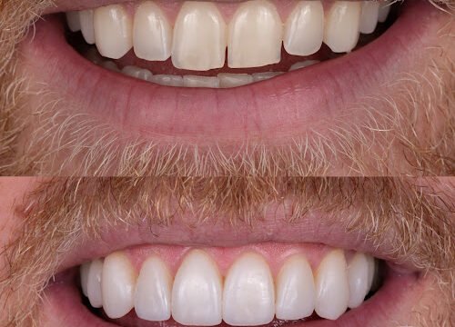 xr:d:DAFpkElNzi0:5,j:8157542367849699159,t:23072416